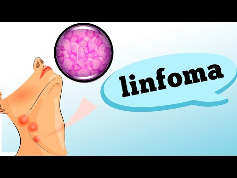 Vídeo: A síndrome do linfonodo mucocutâneo é uma doença?