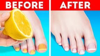 IT’S ALL ABOUT BEAUTY OF YOUR FEET || Pedicure And Shoes Hacks