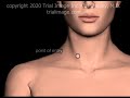Internal jugular vein ijv access normovolemic patient animation by cal shipley md