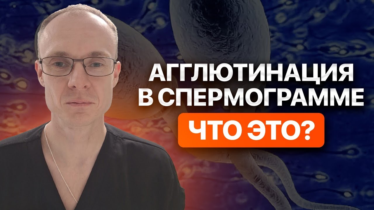 Агглютинация в спермограмме. Что это? Врач уролог-андролог. Москва.