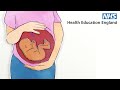 Perinatal and Parent-Infant mental health eLearning