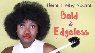 WHY YOUR HAIR IS NOT GROWING | 5 Reasons Why You&#39;re Bald and Edgeless | RITA OKOLO