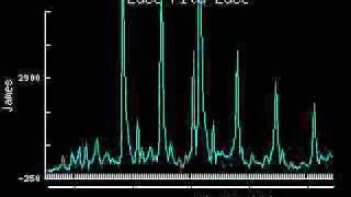Video voorbeeld van "James - Lace Fita Lace"