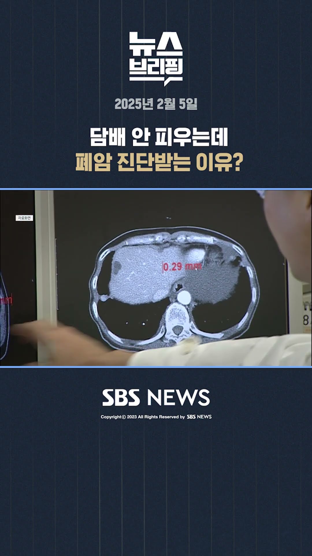 담배 안 피우는데 폐암 진단받는 이유? #shorts
