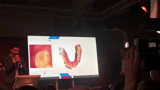 CEREC Primescan Demo