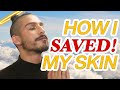 How I Saved My Skin from Acne | Skincare Hacks + Tips I Wish Someone Told Me