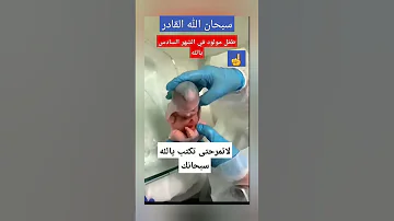 طفل مولود في الشهر السادس سبحان الله القادر 