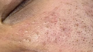 Satisfying and Relaxation with SURI NGUYEN Beauty Spa Video #308