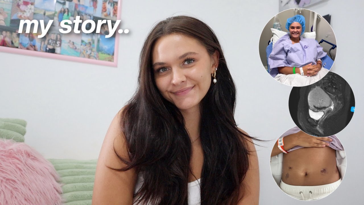 I was diagnosed with endometriosis.. my story, surgery, symptoms