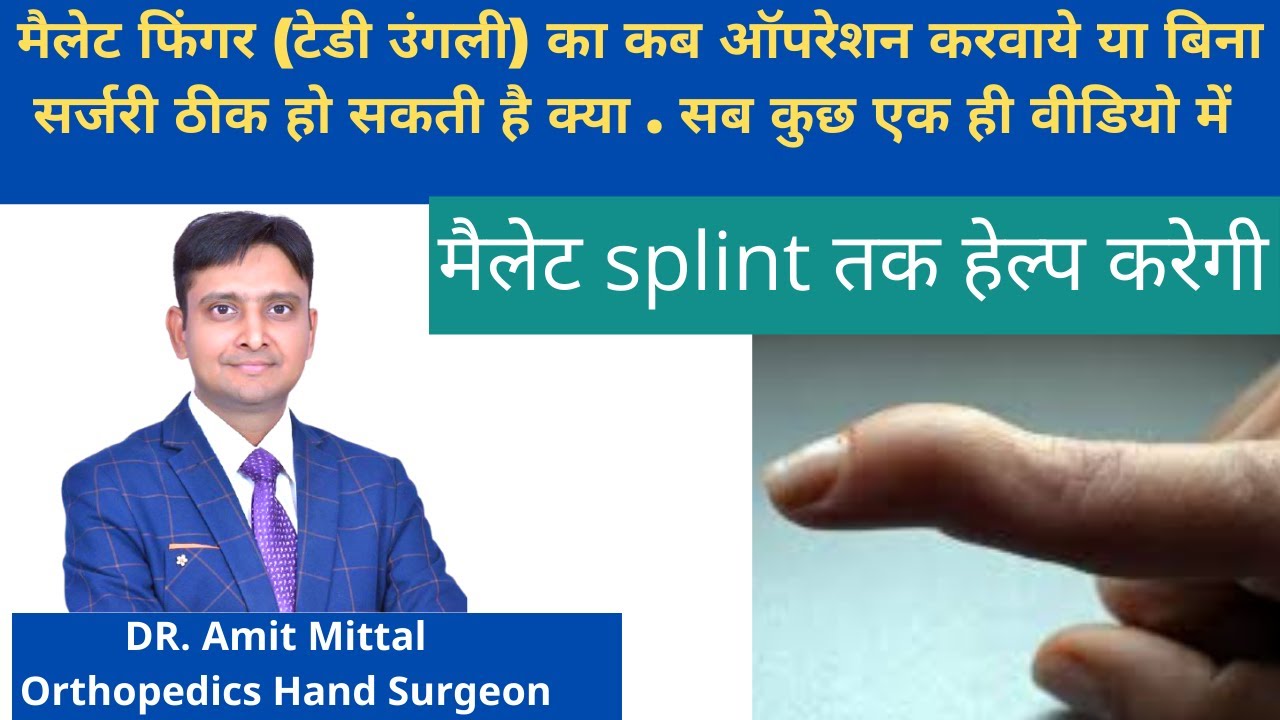 Mallet Finger Treatment In Hindi मैलेट फिंगर की कब सर्जरी करवाये