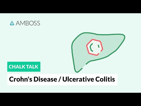 Crohn’s disease and ulcerative colitis: Differences