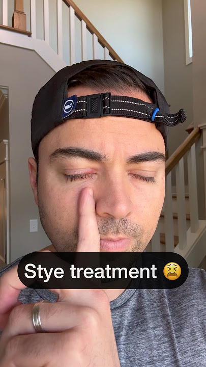 Optometrist gets a stye 👀