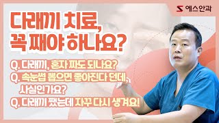 다래끼 치료(다래끼 째기, 다래끼 제거) 수술해야 하나요?