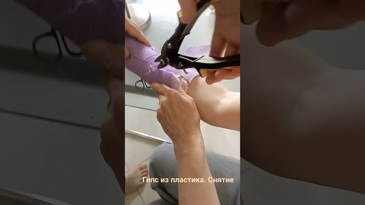 Как снять гипс из пластика. Снимаем. Часть 2.