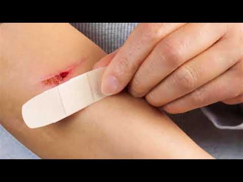 فيديو: هل يجب تغطية الجروح؟