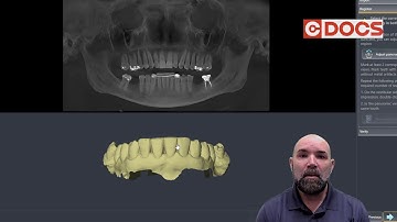 Tip of the Day: Merging CAD CAM and Cone Beam Data