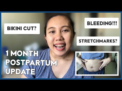 1 MONTH POSTPARTUM UPDATE (Stretchmarks, C-Section Belly Shot, Recovery) | WeTheTZN VLOG #129