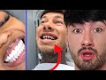 Why is Everyone Getting FAKE Teeth?
