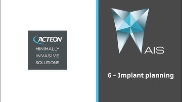 AIS 3D APP - Implant Planning