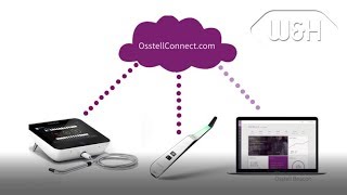 Osstell Beacon - ISQ guides your implant treatments