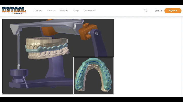 D3Splint WorkFlow: Introduction