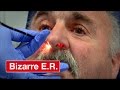 Man Swallows His Dentures - Bizarre ER