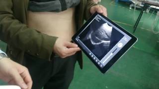 MP-UP02 wireless probe ultrasound scanner screenshot 4