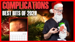 COMPLICATIONS BEST BITS: Watch 2021's most-viewed complications video clips [Aesthetic Mastery Show] screenshot 2