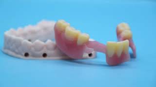 Elevator Pitch - TCS Flexible Partials by Utica Dental Lab 2,156 views 1 year ago 1 minute, 14 seconds