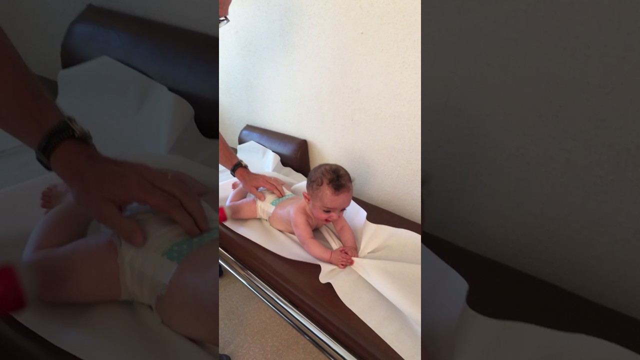 La plagiocéphalie : comment l'inverser ?  - pediatre-online.fr