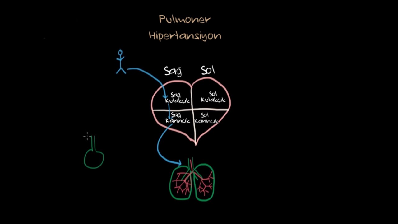Pulmoner Hipertansiyon Nedir? (Fen Bilimleri) (Sağlık ve Tıp)