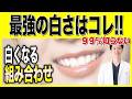 【知らないと損】最強の組み合わせが判明!歯科医師が断言するホワイトニング完全ロードマップ