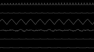 SriK - Concerning Hobbits (NES Oscilloscope View)