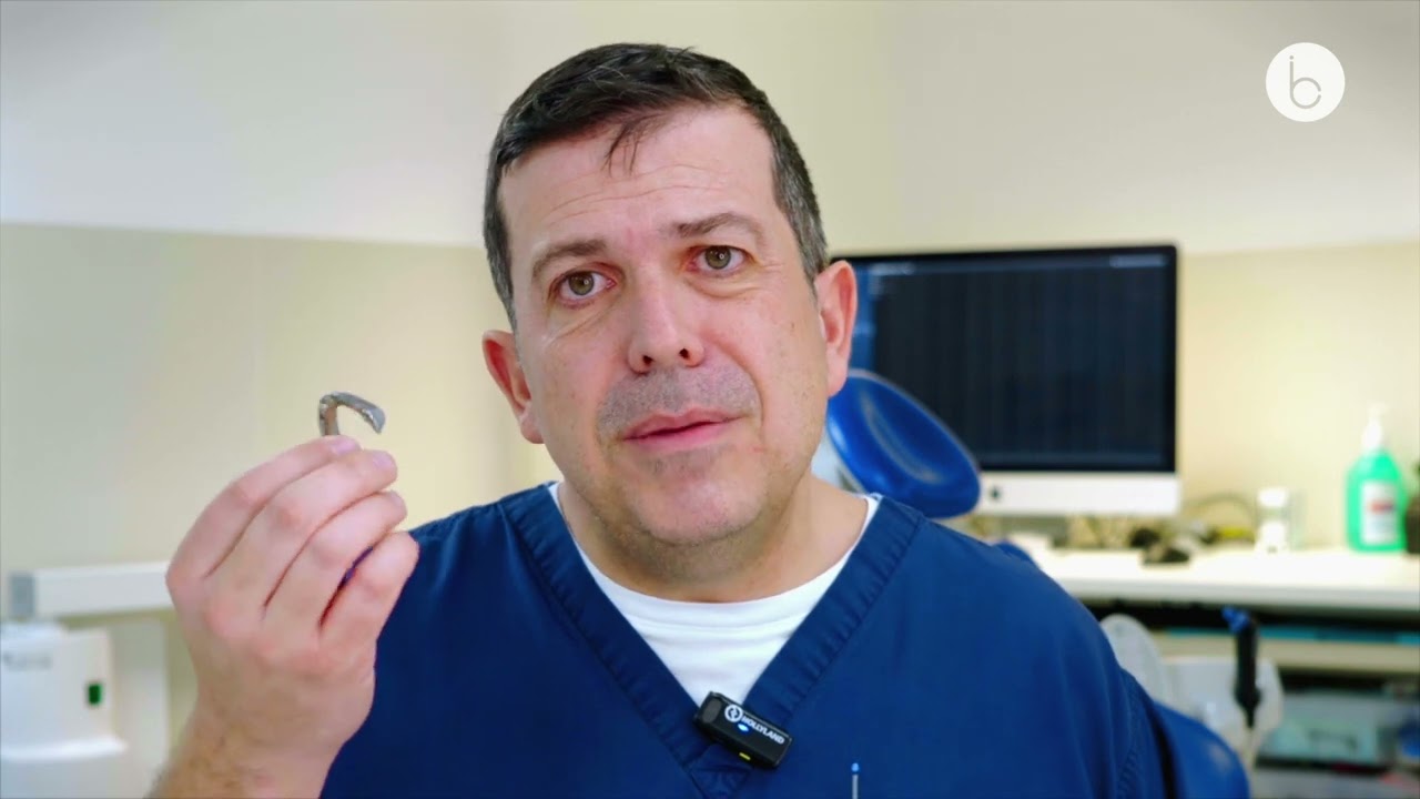 Why Is Zirconia the preferred choice for All-on-4 fixed teeth?