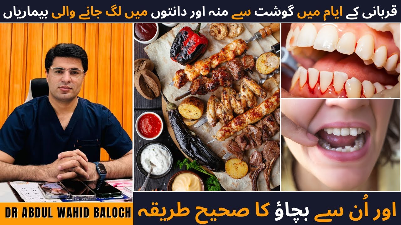 Diseases of Mouth & Teeth from Meat during The Days of Eid ul Adha - Eid ul Adha or Danton Main Dard