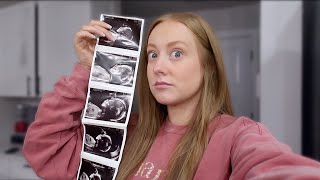 They told us that we are having a BOY?!?!