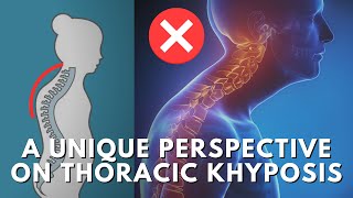 How To Fix The Root Cause Of Thoracic Kyphosis & Upper Crossed Syndrome (Hunchback Posture)