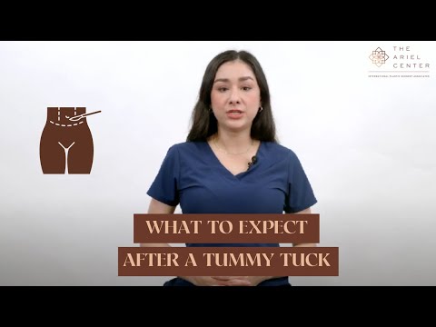 What to expect right after your Abdominoplasty Surgery?