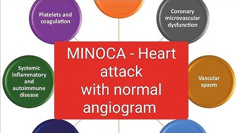 #MINOCA Myocardial Infarction in  Non obstructive coronary artery #inoca #cad #angiography