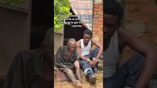 Even $1 saves Kagwa get leprosy treatment.(GOFUNDME LINK IN BIO). #nakajubianita #fyp
