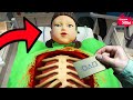 Doing the operation Squid Game (오징어 게임) vs Scary Teacher 3D Miss T and Granny funny animation