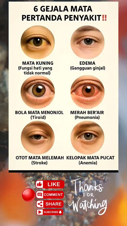 6 gejala mata belum banyak yang tau#tipssehat #tipspraktis