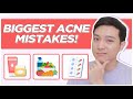 ACNE MISTAKES to AVOID for CLEAR SKIN! My Acne Journey Mistakes (Filipino) | Jan Angelo