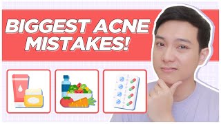 ACNE MISTAKES to AVOID for CLEAR SKIN! My Acne Journey Mistakes (Filipino) | Jan Angelo