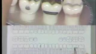 Dental Charting Procedures