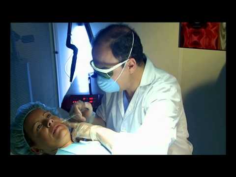 Implantes de Relleno