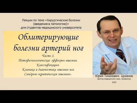 Облитерирующие болезни артерий нижних конечностей. Часть 1  Лекция для студентов медуниверситета