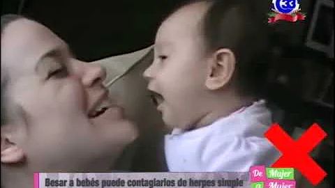 ¿Puedo besar a mi bebé si tengo herpes labial?