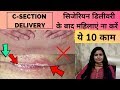 Care After Cesarean Delivery | सिजेरियन डिलीवरी के बाद कैसे रखें ख्याल?| C-Section Delivery in Hindi