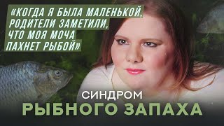 Синдром рыбного запаха  | Хочу спросить